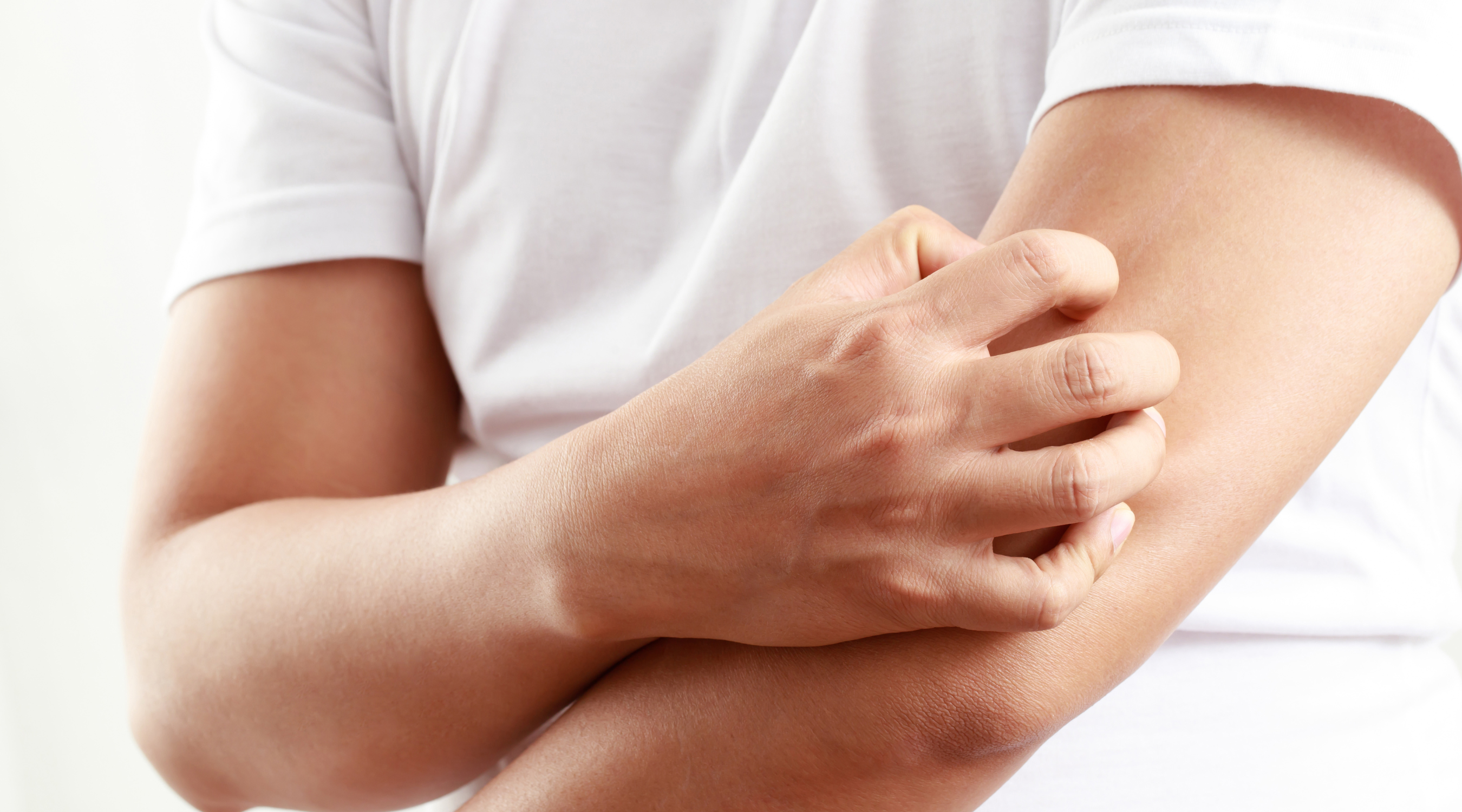 Discoid Eczema and how to treat it