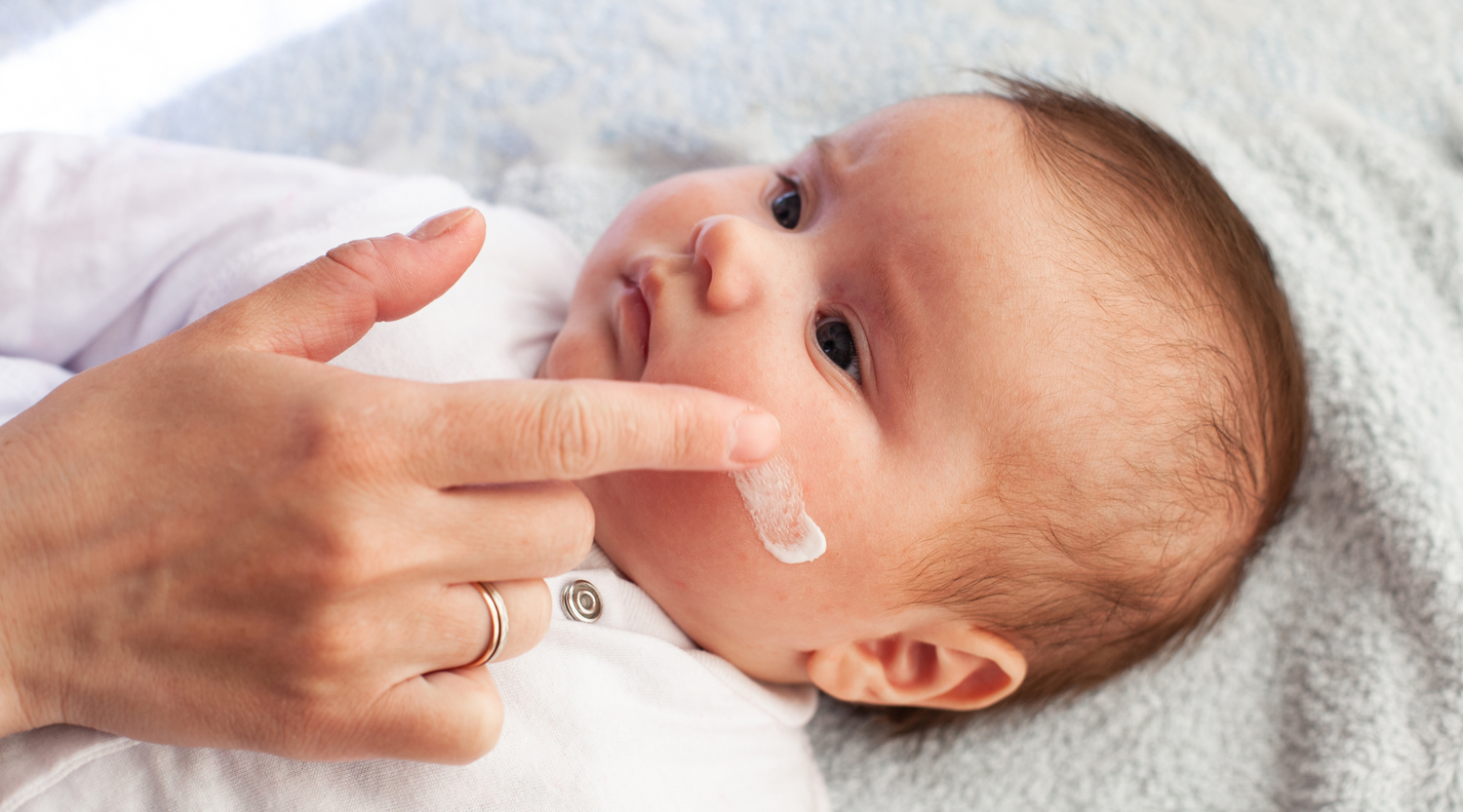 Eczema In Babies & Children