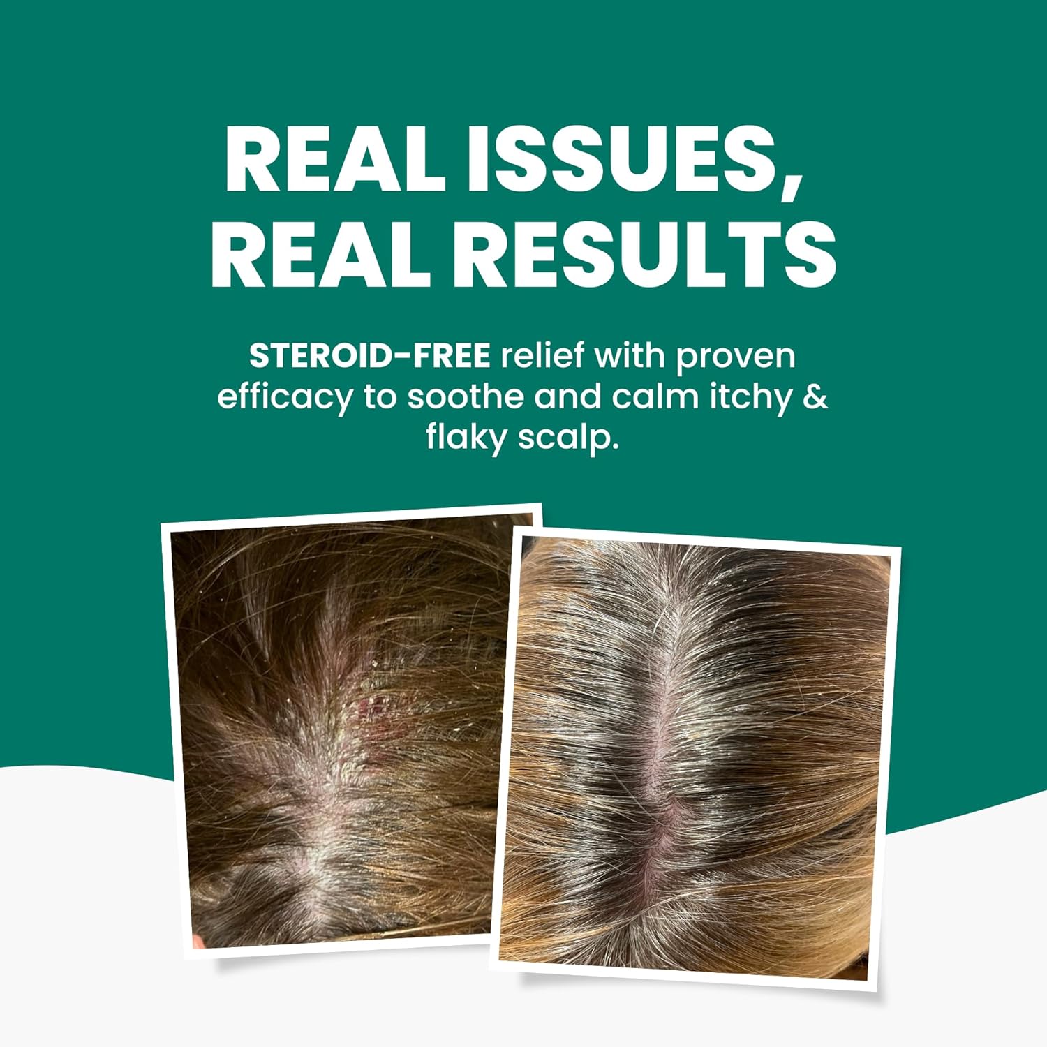 Scalp Relief Shampoo