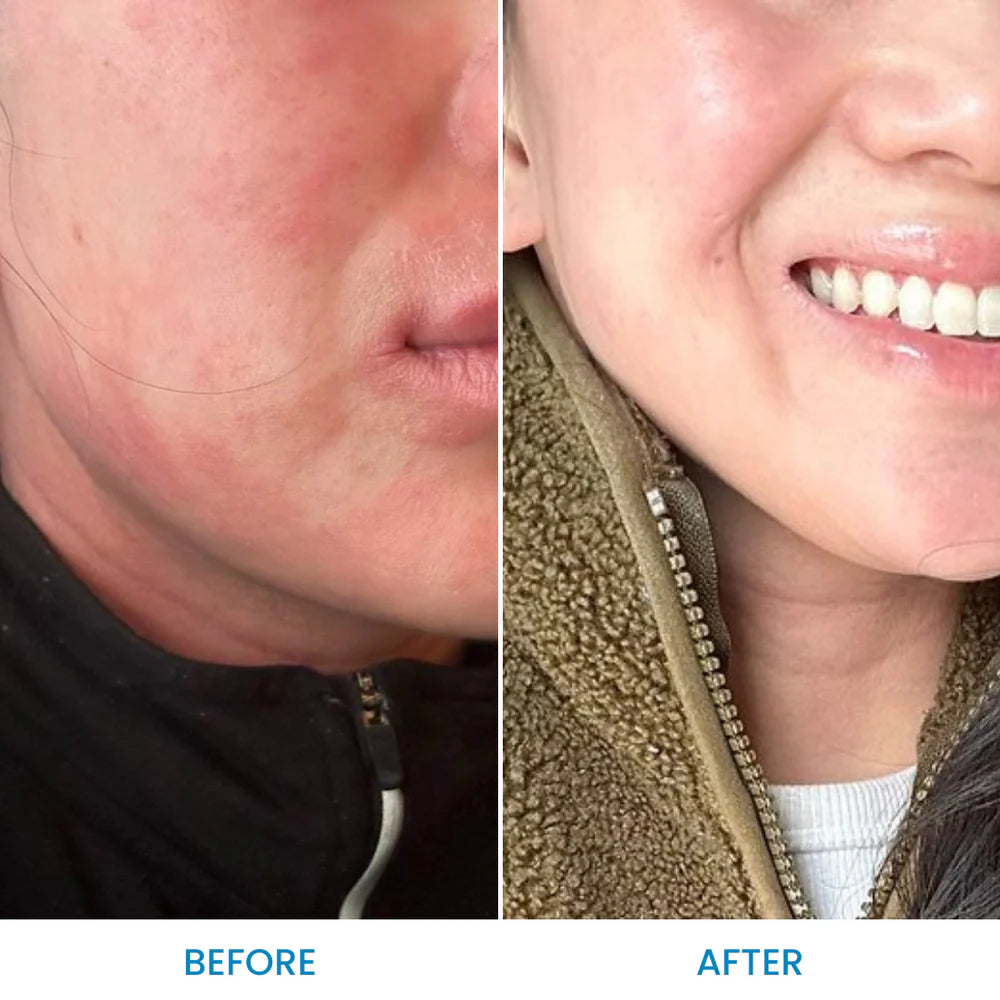 Face & Eyelid Eczema Cream Grahams Natural